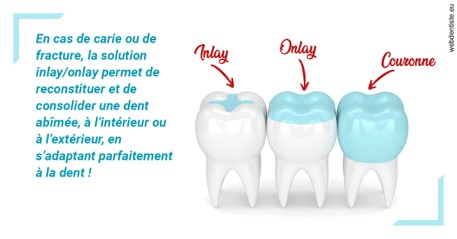 https://dr-ari-djebali.chirurgiens-dentistes.fr/L'INLAY ou l'ONLAY