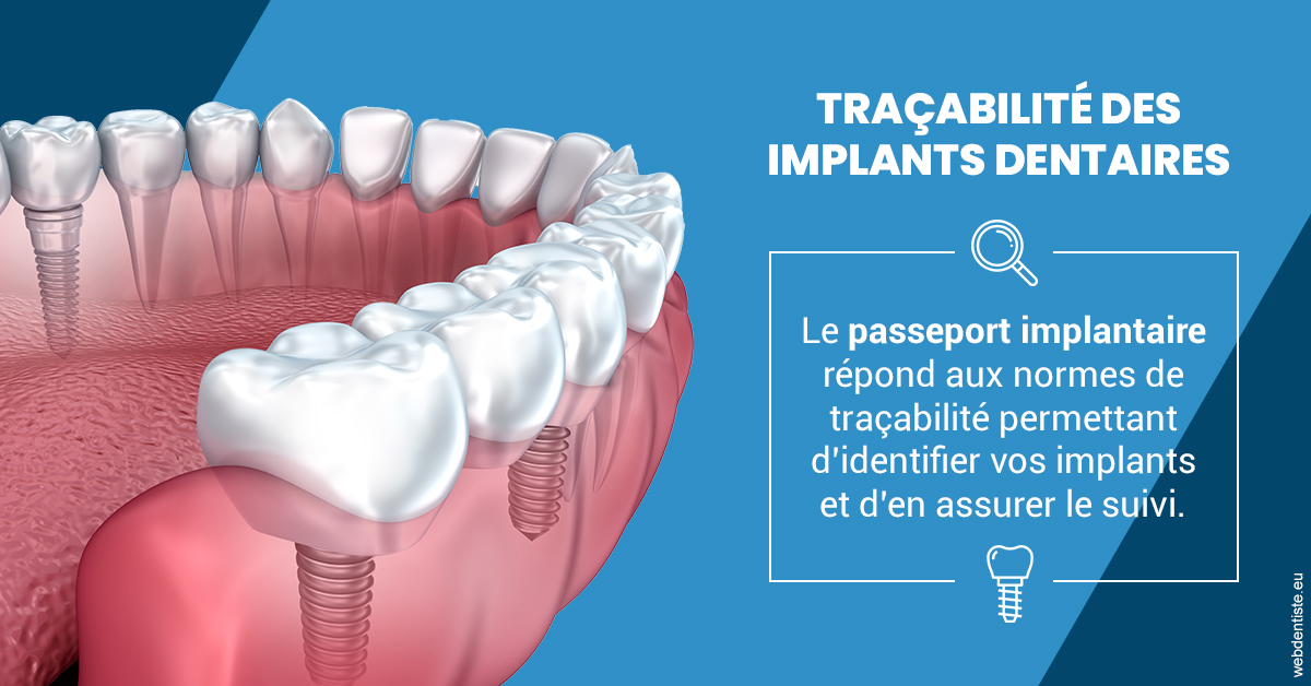 https://dr-ari-djebali.chirurgiens-dentistes.fr/T2 2023 - Traçabilité des implants 1