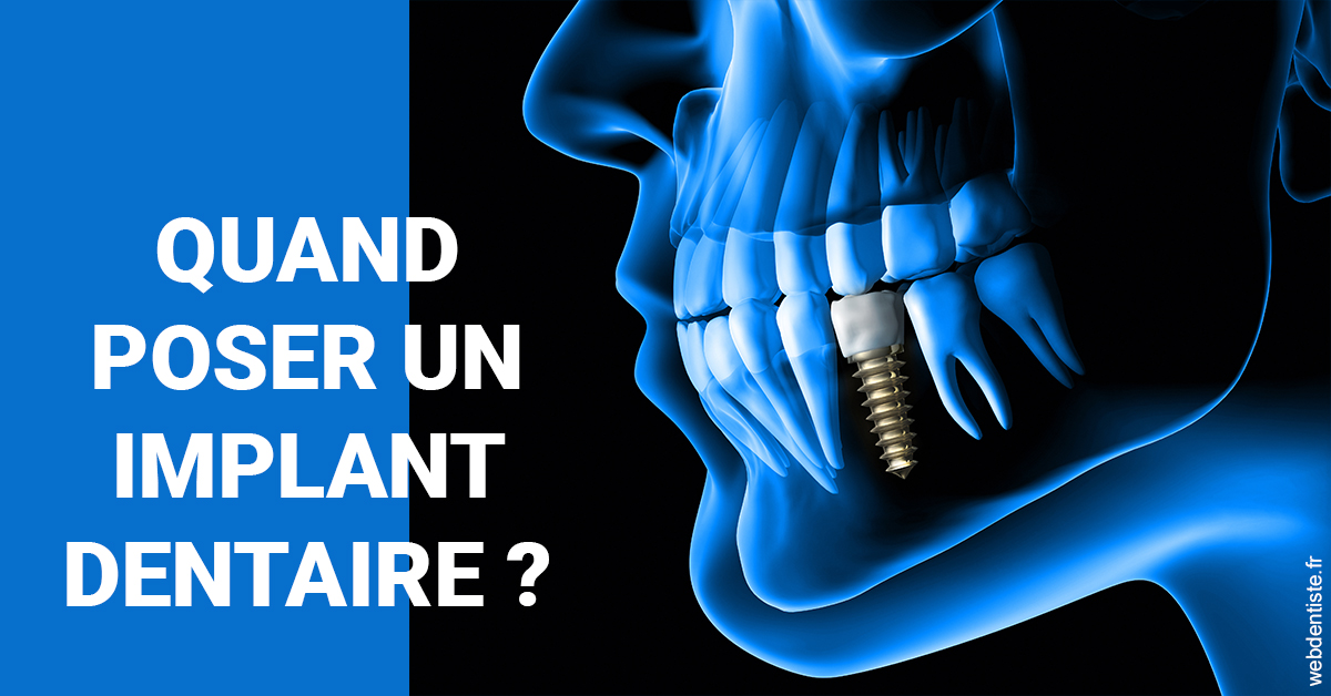 https://dr-ari-djebali.chirurgiens-dentistes.fr/Les implants 1