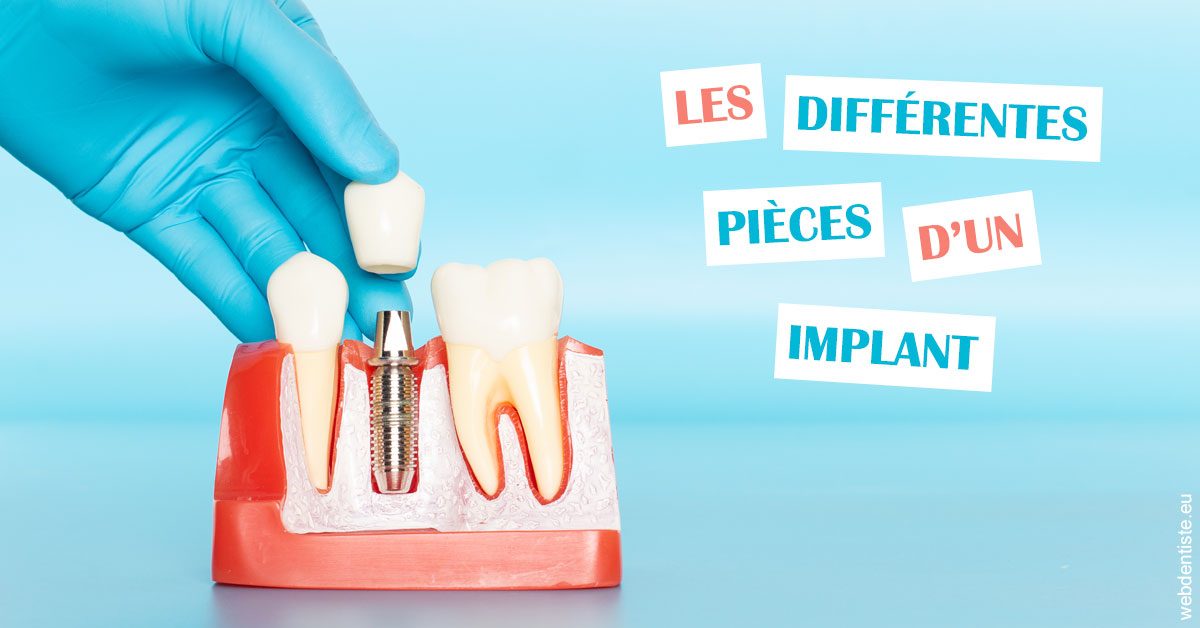 https://dr-ari-djebali.chirurgiens-dentistes.fr/Les différentes pièces d’un implant 2