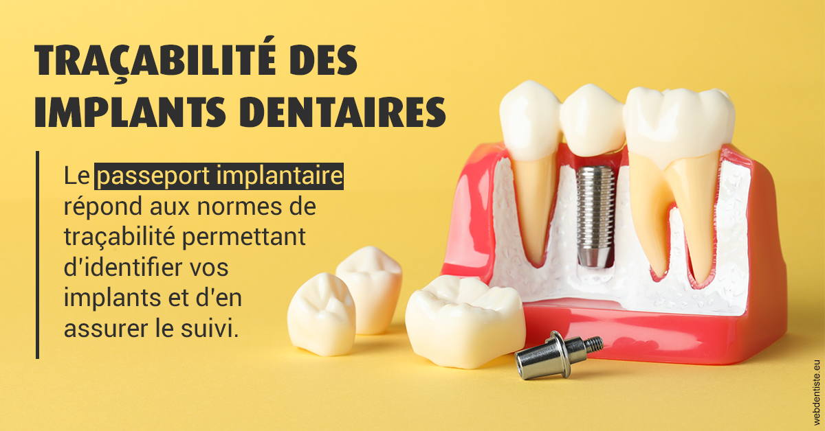 https://dr-ari-djebali.chirurgiens-dentistes.fr/T2 2023 - Traçabilité des implants 2