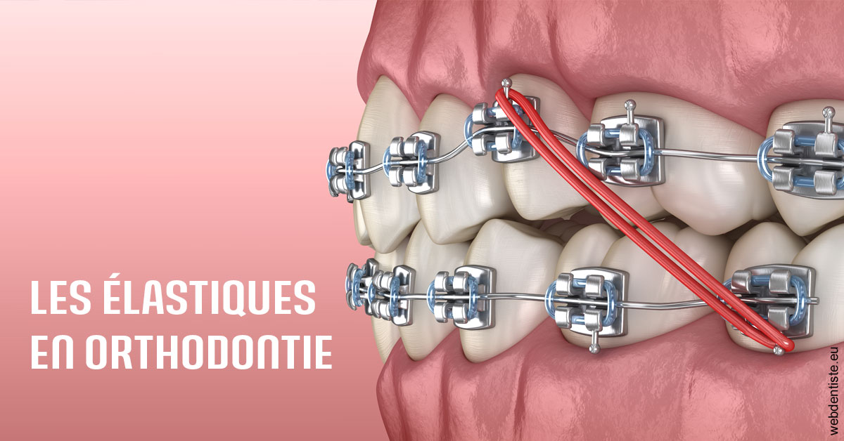 https://dr-ari-djebali.chirurgiens-dentistes.fr/Elastiques orthodontie 2