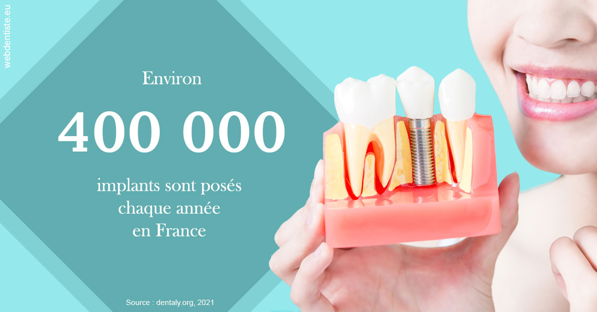 https://dr-ari-djebali.chirurgiens-dentistes.fr/Pose d'implants en France 2