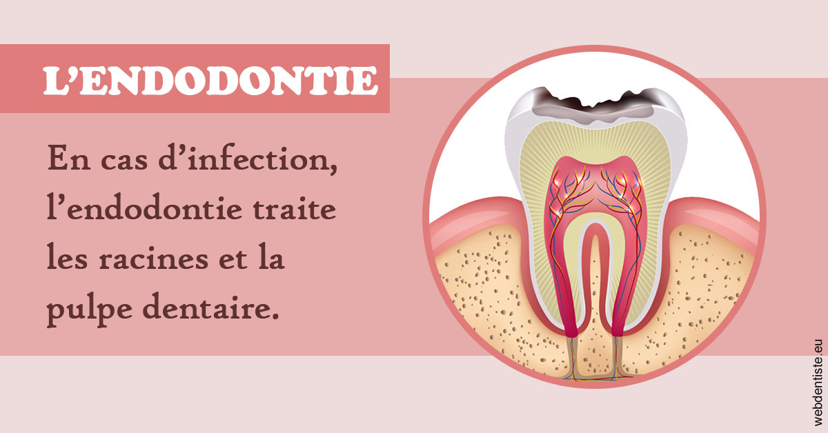 https://dr-ari-djebali.chirurgiens-dentistes.fr/L'endodontie 2