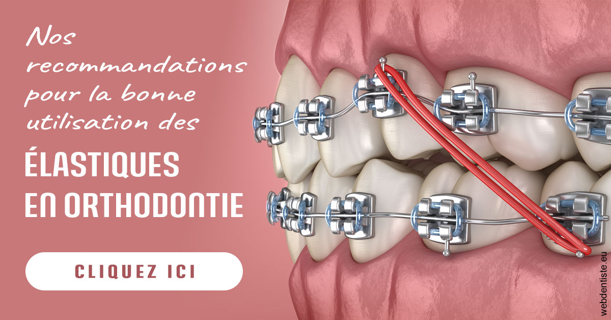 https://dr-ari-djebali.chirurgiens-dentistes.fr/Elastiques orthodontie 2